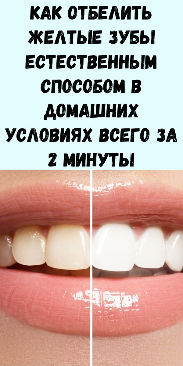 Как отбелить желтые зубы естественным способом в домашних условиях всего за 2 минуты
