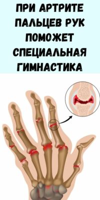 При артрите пальцев рук поможет специальная гимнастика - Журнал для женщин