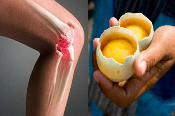 Возьмите 2 яйца — они избавят от боли в колени и "исправят" суставы