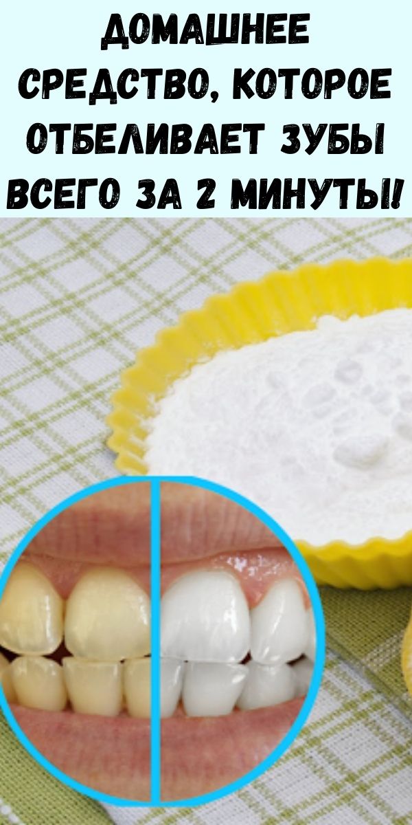 Домашнее средство, которое отбеливает зубы всего за 2 минуты!