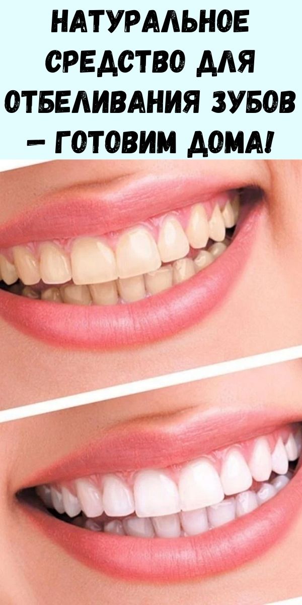 Натуральное средство для отбеливания зубов — готовим дома! Стоматолог не поверил, когда увидел результат!