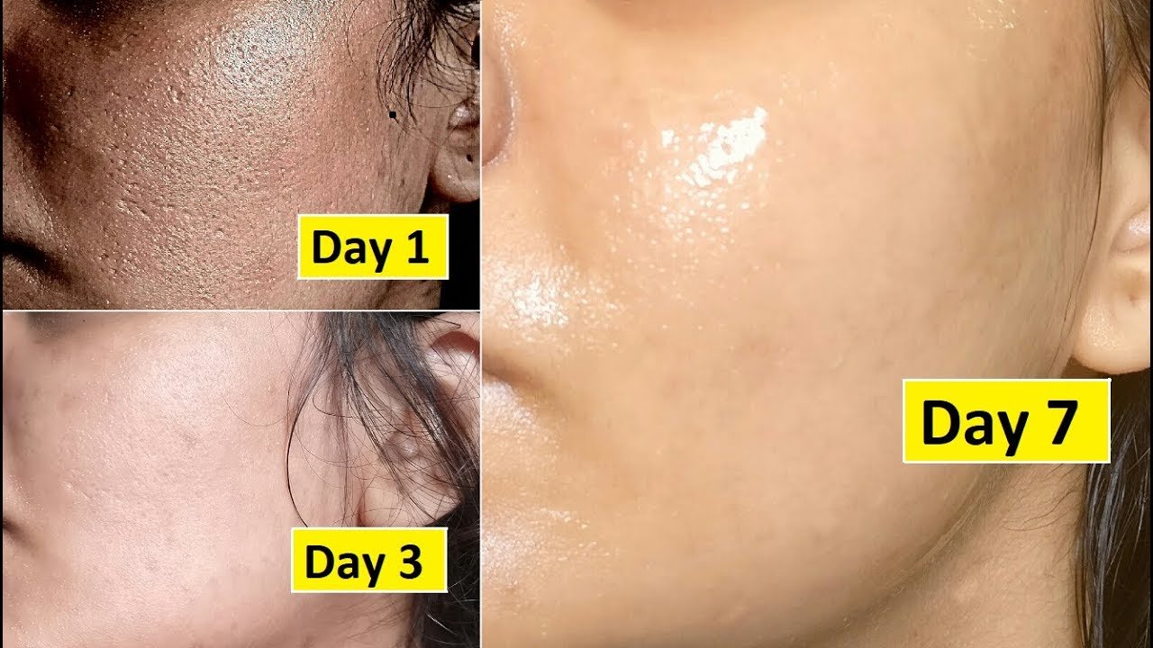 3-дневная процедура ухода за кожей, Ваша кожа будет выглядеть на 10 лет моложе и безупречно