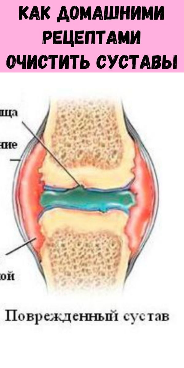 Как домашними рецептами очистить суставы