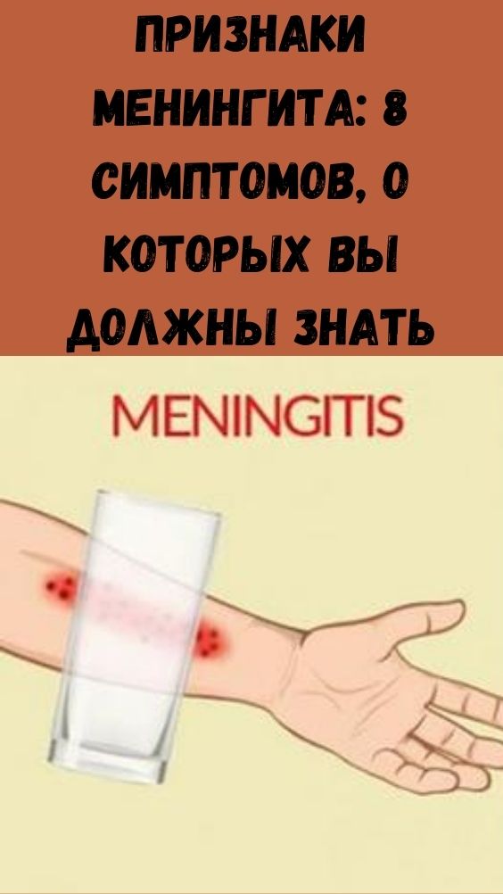Признаки менингита: 8 симптомов, о которых вы должны знать